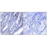 Immunohistochemistry - PKA-R2β (Ab-113) Antibody from Signalway Antibody (33161) - Antibodies.com