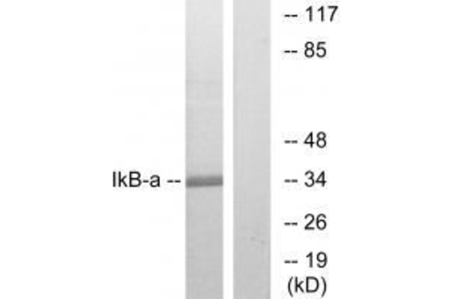 Western blot - IκB-α (Ab-32/36) Antibody from Signalway Antibody (33192) - Antibodies.com