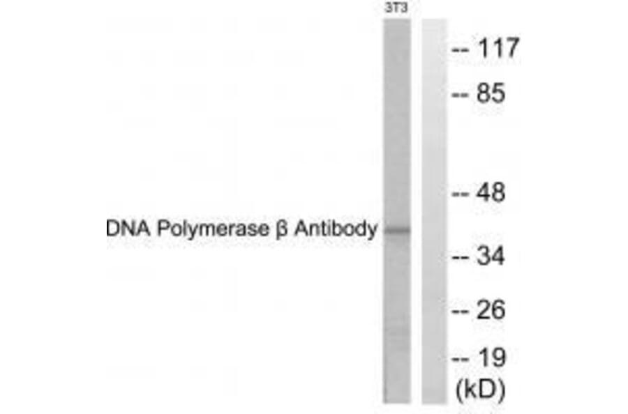 Western blot - DNA Polymerase β Antibody from Signalway Antibody (33357) - Antibodies.com
