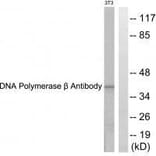 Western blot - DNA Polymerase β Antibody from Signalway Antibody (33357) - Antibodies.com