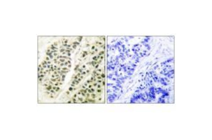 Immunohistochemistry - DNA Polymerase β Antibody from Signalway Antibody (33357) - Antibodies.com