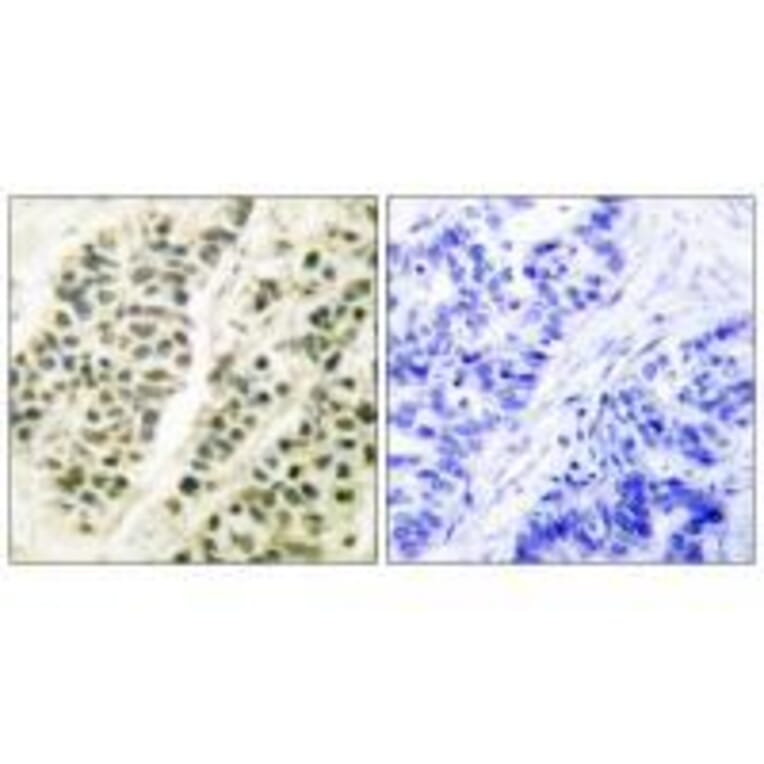 Immunohistochemistry - DNA Polymerase β Antibody from Signalway Antibody (33357) - Antibodies.com