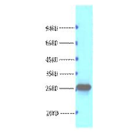 Western blot - Bcl-2 Monoclonal Antibody from Signalway Antibody (40415) - Antibodies.com