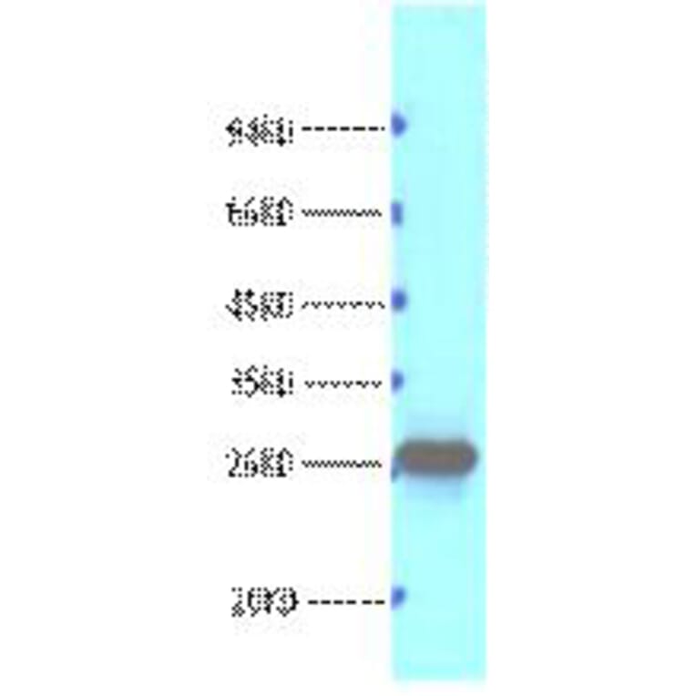 Western blot - Bcl-2 Monoclonal Antibody from Signalway Antibody (40415) - Antibodies.com