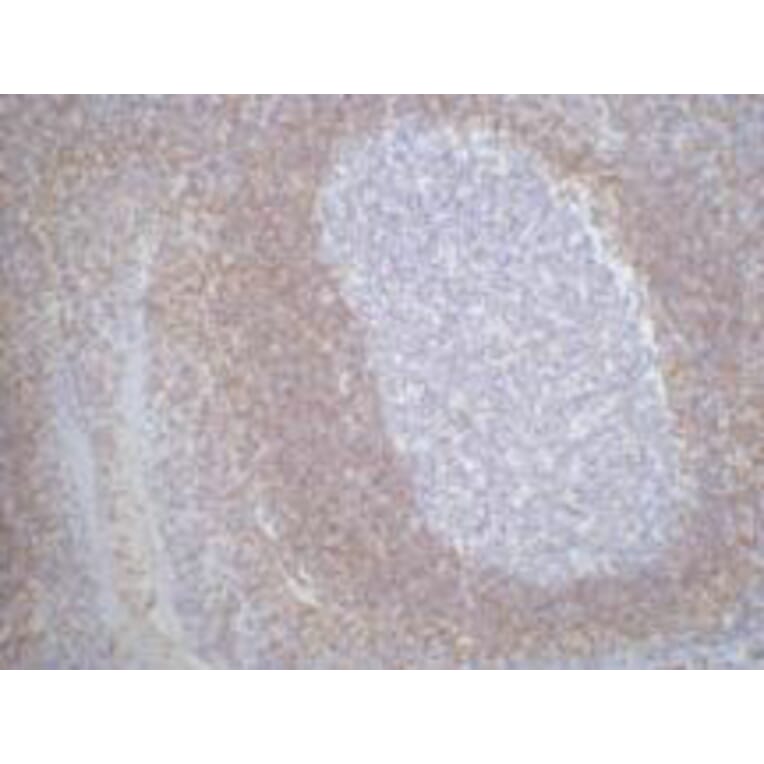 Bcl-2 Monoclonal Antibody from Signalway Antibody (40415) - Antibodies.com