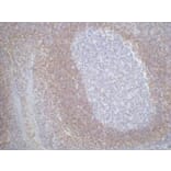 Bcl-2 Monoclonal Antibody from Signalway Antibody (40415) - Antibodies.com