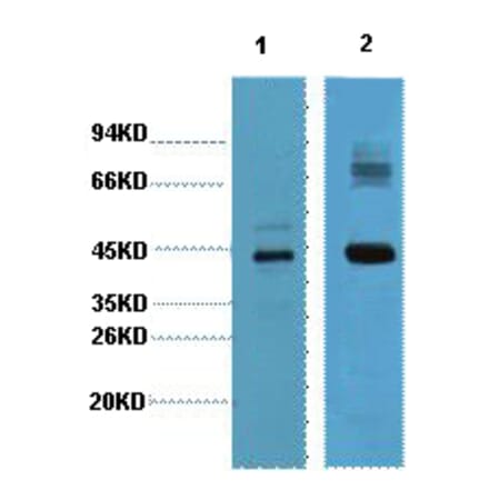 Western blot - AMACR Monoclonal Antibody from Signalway Antibody (40421) - Antibodies.com