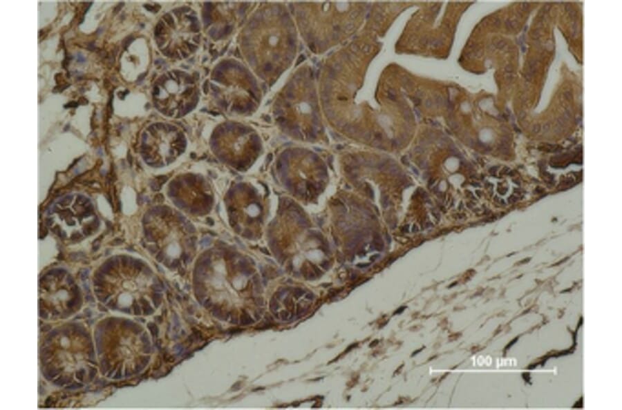 Immunohistochemistry - α-SMA Monoclonal Antibody from Signalway Antibody (40482) - Antibodies.com