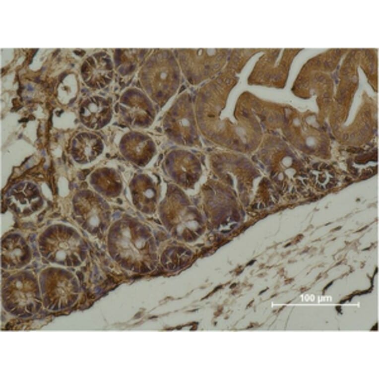 Immunohistochemistry - α-SMA Monoclonal Antibody from Signalway Antibody (40482) - Antibodies.com