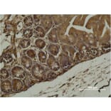 Immunohistochemistry - α-SMA Monoclonal Antibody from Signalway Antibody (40482) - Antibodies.com