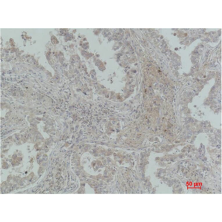 Immunohistochemistry - MICU1 Monoclonal Antibody from Signalway Antibody (40490) - Antibodies.com