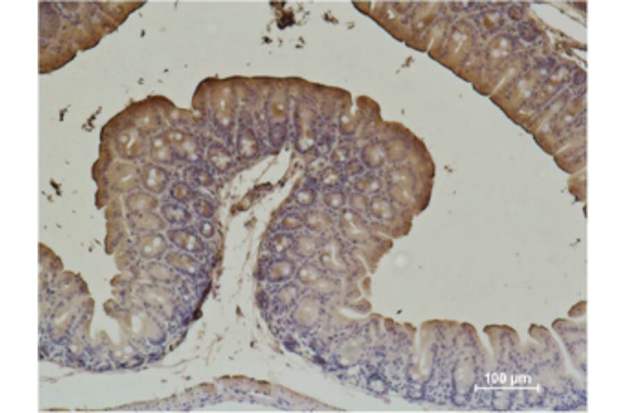 Immunohistochemistry - α-SMA Monoclonal Antibody from Signalway Antibody (40495) - Antibodies.com