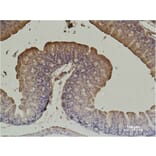 Immunohistochemistry - α-SMA Monoclonal Antibody from Signalway Antibody (40495) - Antibodies.com