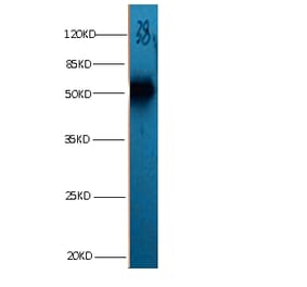 ANXA2 Monoclonal Antibody from Signalway Antibody (42021) - Antibodies.com