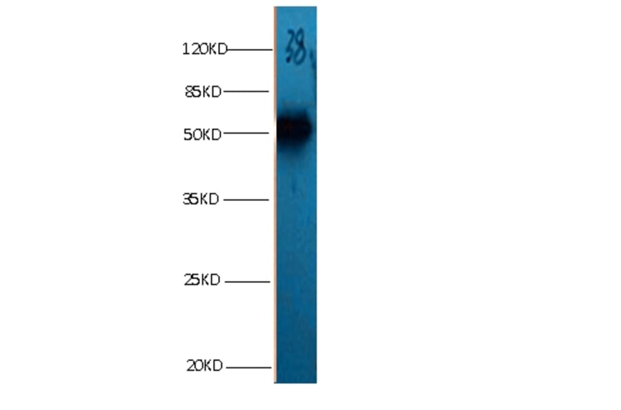 ANXA2 Monoclonal Antibody from Signalway Antibody (42021) - Antibodies.com