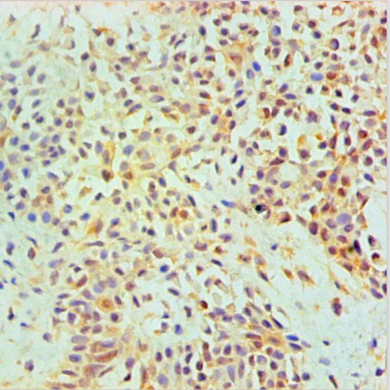 Immunohistochemistry - ANXA2 Monoclonal Antibody from Signalway Antibody (42021) - Antibodies.com