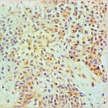 Immunohistochemistry - ANXA2 Monoclonal Antibody from Signalway Antibody (42021) - Antibodies.com