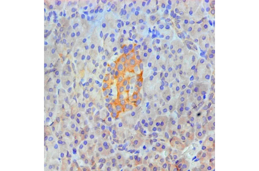 Immunohistochemistry - ANXA2 Monoclonal Antibody from Signalway Antibody (42021) - Antibodies.com
