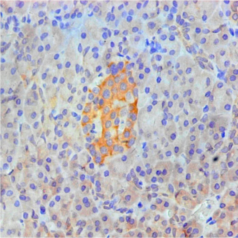 Immunohistochemistry - ANXA2 Monoclonal Antibody from Signalway Antibody (42021) - Antibodies.com