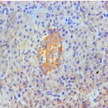 Immunohistochemistry - ANXA2 Monoclonal Antibody from Signalway Antibody (42021) - Antibodies.com