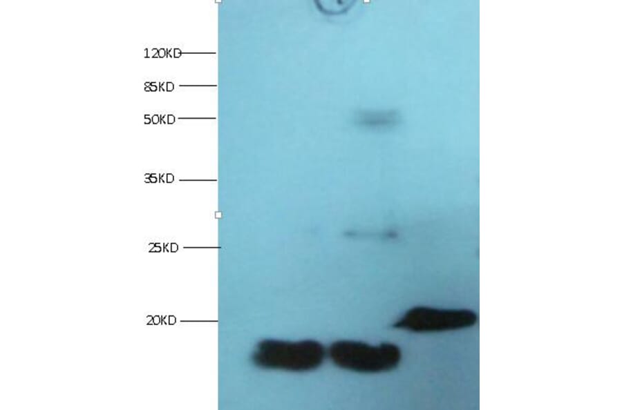 FABP3 Monoclonal Antibody from Signalway Antibody (42038) - Antibodies.com