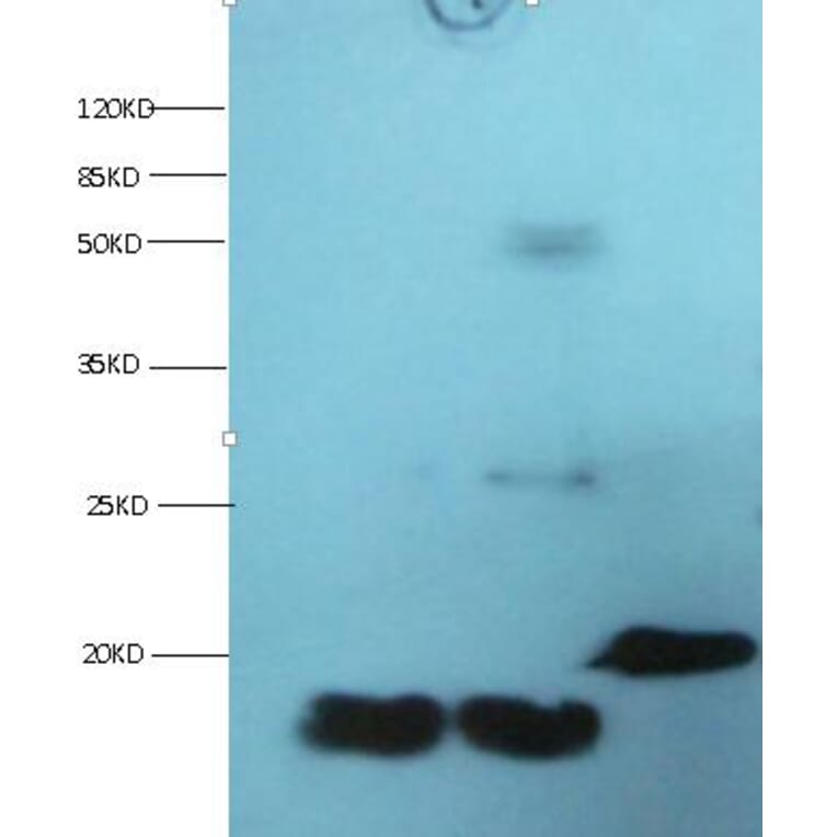 FABP3 Monoclonal Antibody from Signalway Antibody (42038) - Antibodies.com