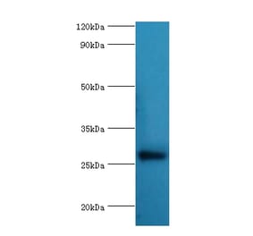 NAA10 Polyclonal Antibody from Signalway Antibody (42070) - Antibodies.com