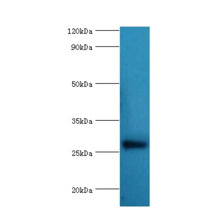 NAA10 Polyclonal Antibody from Signalway Antibody (42070) - Antibodies.com