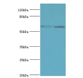 ASMTL Polyclonal Antibody from Signalway Antibody (42075) - Antibodies.com