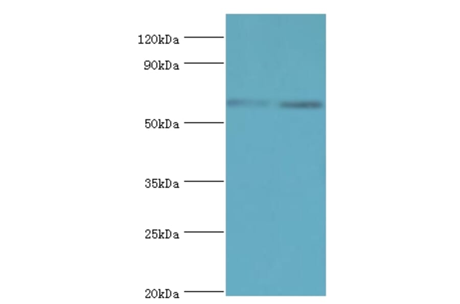 ASMTL Polyclonal Antibody from Signalway Antibody (42075) - Antibodies.com
