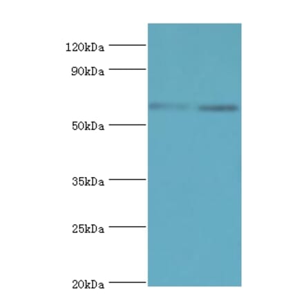 ASMTL Polyclonal Antibody from Signalway Antibody (42075) - Antibodies.com