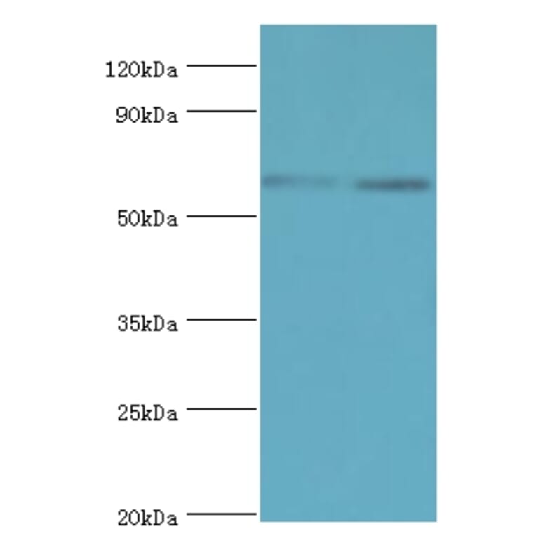 ASMTL Polyclonal Antibody from Signalway Antibody (42075) - Antibodies.com