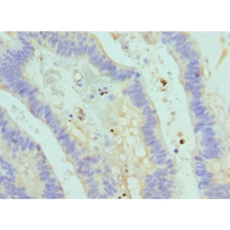 Immunohistochemistry - ASMTL Polyclonal Antibody from Signalway Antibody (42075) - Antibodies.com