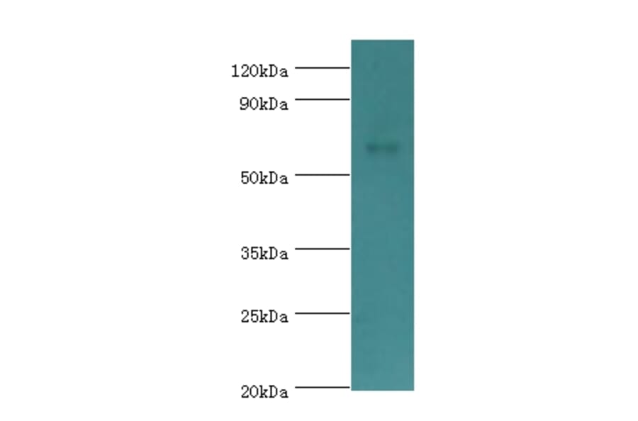 CHRM3 Polyclonal Antibody from Signalway Antibody (42122) - Antibodies.com