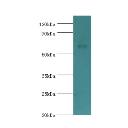 CHRM3 Polyclonal Antibody from Signalway Antibody (42122) - Antibodies.com