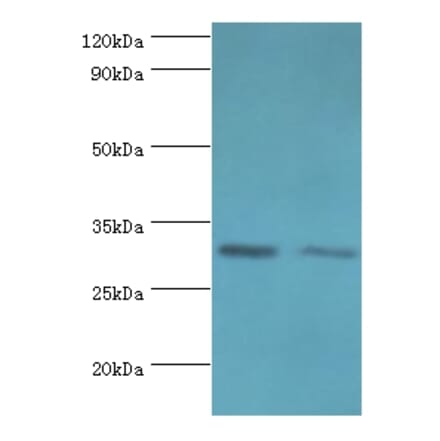 CLIC4 Polyclonal Antibody from Signalway Antibody (42126) - Antibodies.com