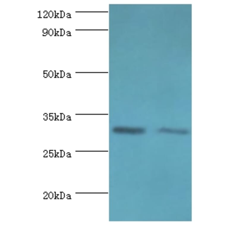 CLIC4 Polyclonal Antibody from Signalway Antibody (42126) - Antibodies.com