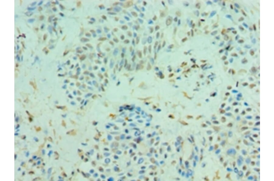 Immunohistochemistry - CLIC4 Polyclonal Antibody from Signalway Antibody (42126) - Antibodies.com