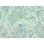 Immunohistochemistry - CLIC4 Polyclonal Antibody from Signalway Antibody (42126) - Antibodies.com