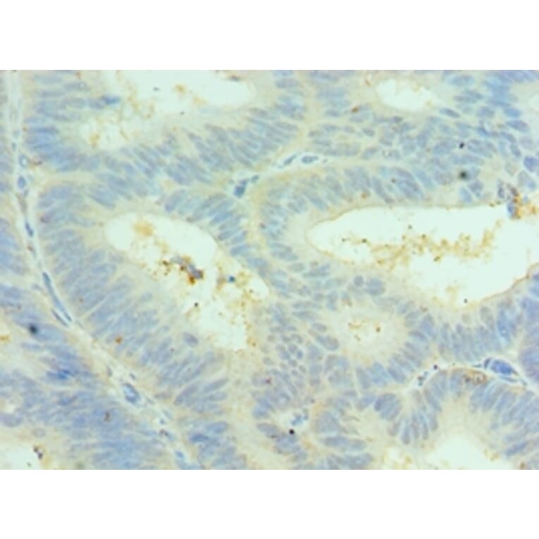 Immunohistochemistry - CLIC4 Polyclonal Antibody from Signalway Antibody (42126) - Antibodies.com