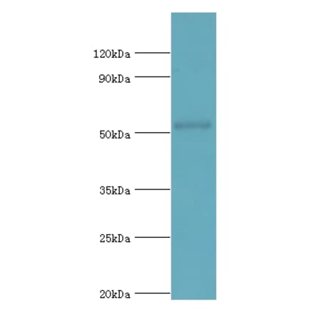 COPS2 Polyclonal Antibody from Signalway Antibody (42133) - Antibodies.com