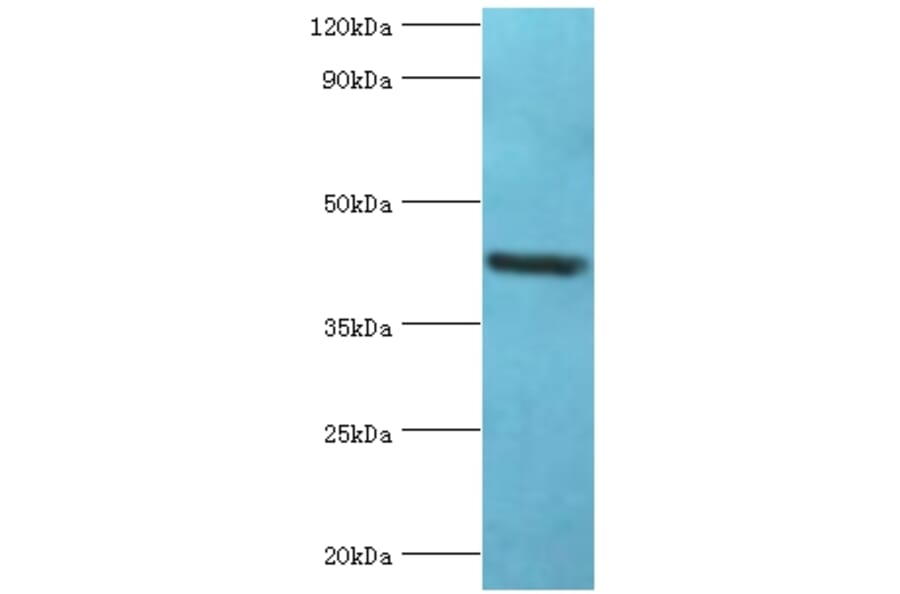 GOLM1 Polyclonal Antibody from Signalway Antibody (42187) - Antibodies.com