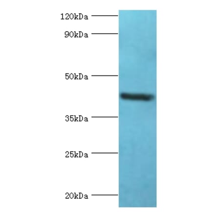 GOLM1 Polyclonal Antibody from Signalway Antibody (42187) - Antibodies.com