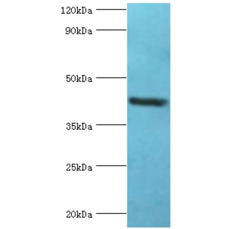 GOLM1 Polyclonal Antibody from Signalway Antibody (42187) - Antibodies.com