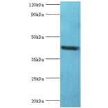 GOLM1 Polyclonal Antibody from Signalway Antibody (42187) - Antibodies.com