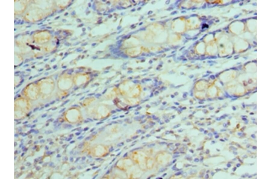 Immunohistochemistry - GOLM1 Polyclonal Antibody from Signalway Antibody (42187) - Antibodies.com