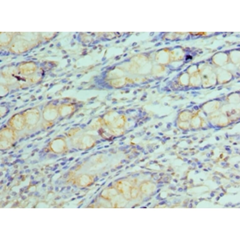 Immunohistochemistry - GOLM1 Polyclonal Antibody from Signalway Antibody (42187) - Antibodies.com