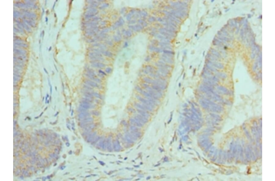 Immunohistochemistry - GOLM1 Polyclonal Antibody from Signalway Antibody (42187) - Antibodies.com