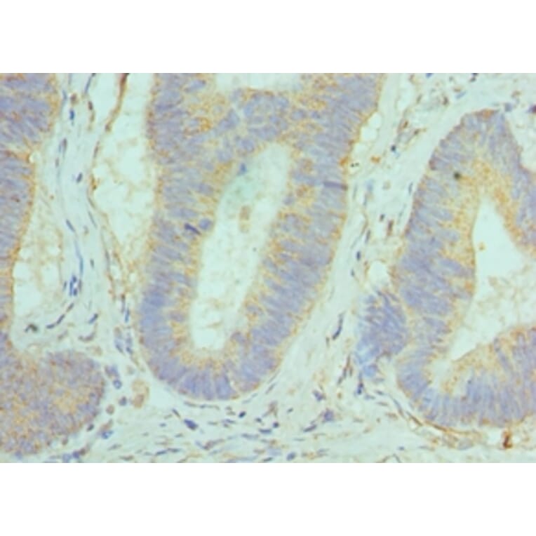 Immunohistochemistry - GOLM1 Polyclonal Antibody from Signalway Antibody (42187) - Antibodies.com