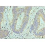 Immunohistochemistry - GOLM1 Polyclonal Antibody from Signalway Antibody (42187) - Antibodies.com